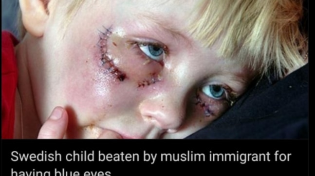 Fact Check: This European kid was not beaten up by a Muslim immigrant for having blue eyes