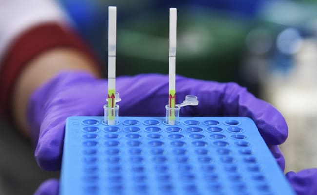 UK Testing Error Wrongly Tells 1,300 People They Have Coronavirus