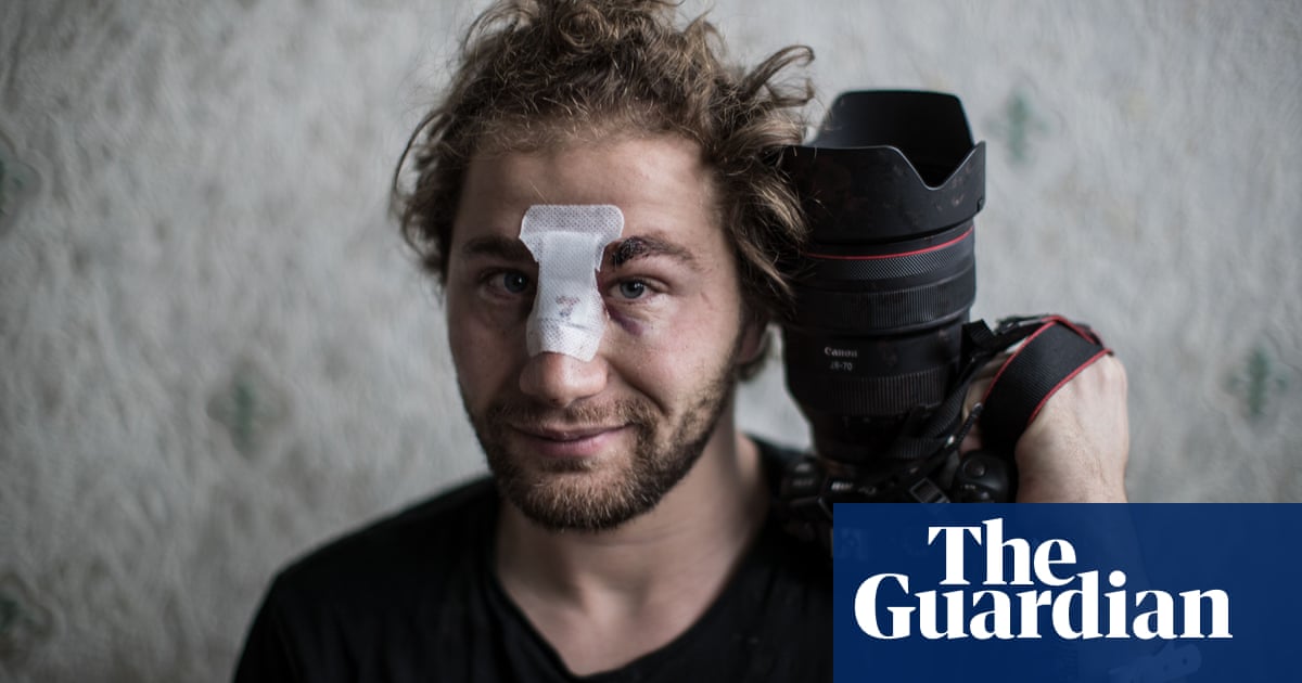 French inquiry begins into alleged assault on photographer by police