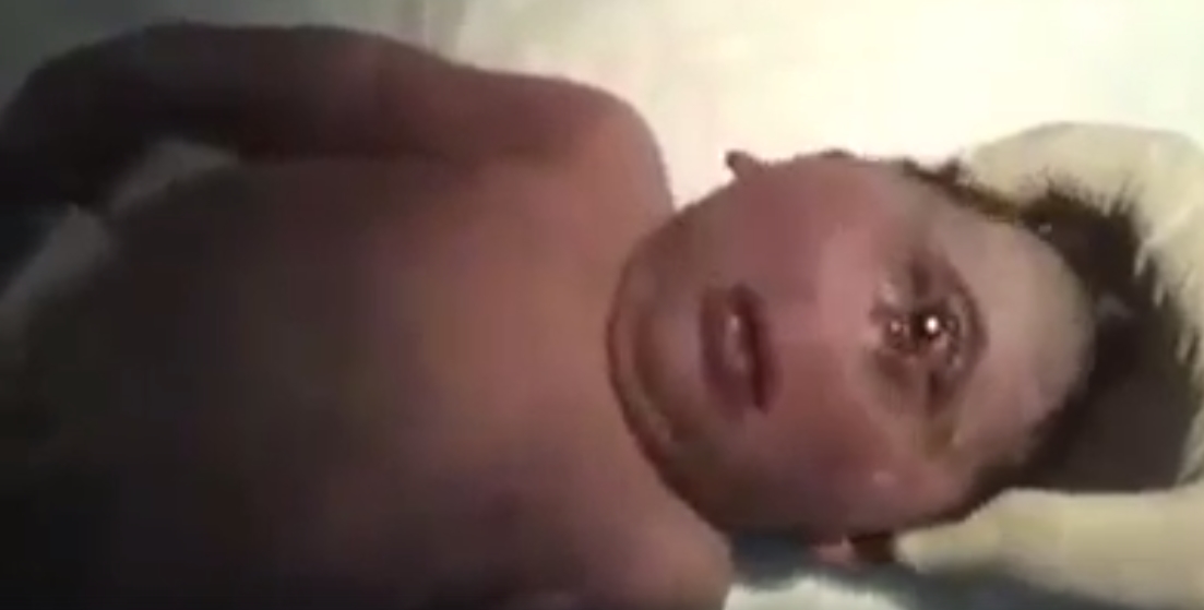 Old video of baby with rare birth defect shared as advent of 'Antichrist' born in Israel - Alt News