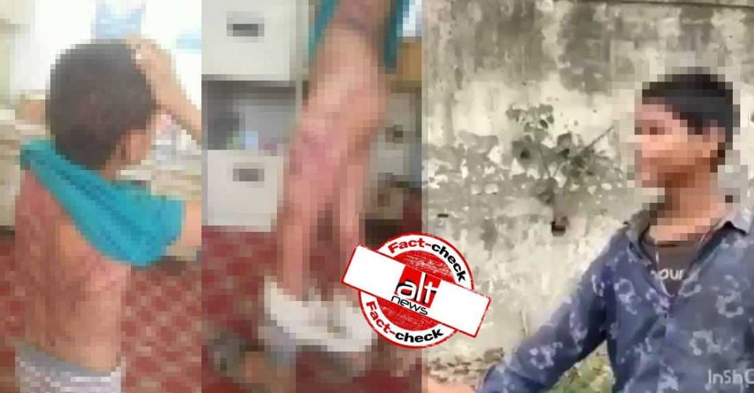 Photos from Yemen viral as injuries of Muslim boy beaten for entering temple to drink water - Alt News