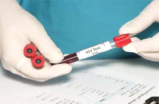 बच्चे को HIV पॉजिटिव खून चढ़ाने का मामला: सिविल सर्जन रिकार्ड सहित चंडीगढ़ तलब - mobile
