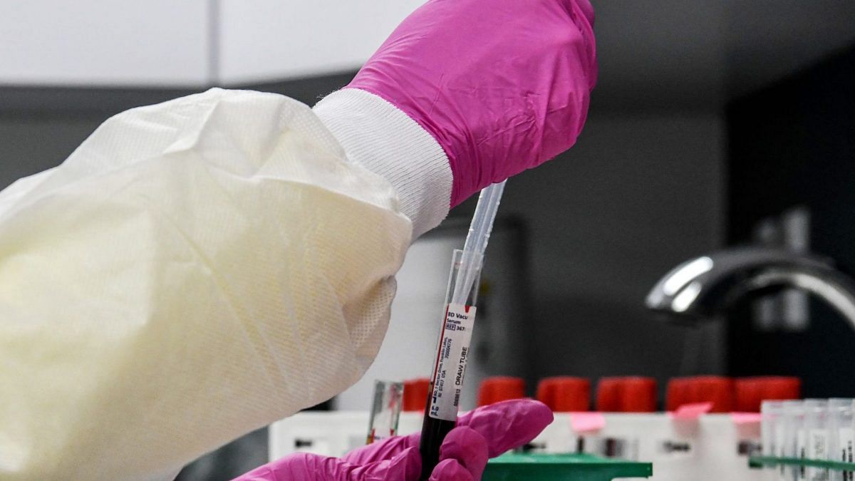 Pfizer, BioNTech seek regulatory clearance from EU for Covid vaccine