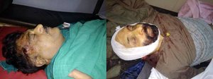 Jammu & Kashmir BJP secretary and his brother shot dead in Kishtwar, region tense
