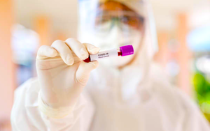 Coronavirus pandemic: Worldwide death toll tops 100,000, WHO warns of ‘deadly resurgence’